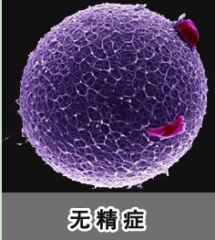 男性无精症有什么症状?